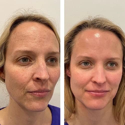 Anti-Aging
